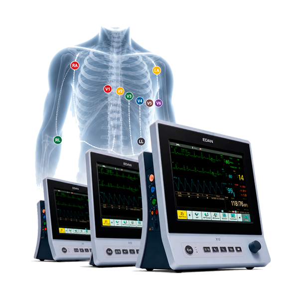 Option ECG 6-12 dérivations pour moniteur Edan X séries
