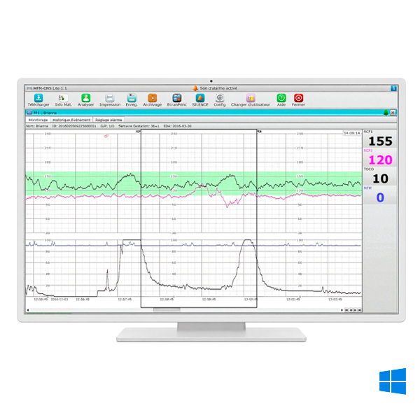 logiciel edan mfm-cns lite pour cardiotocographes edan