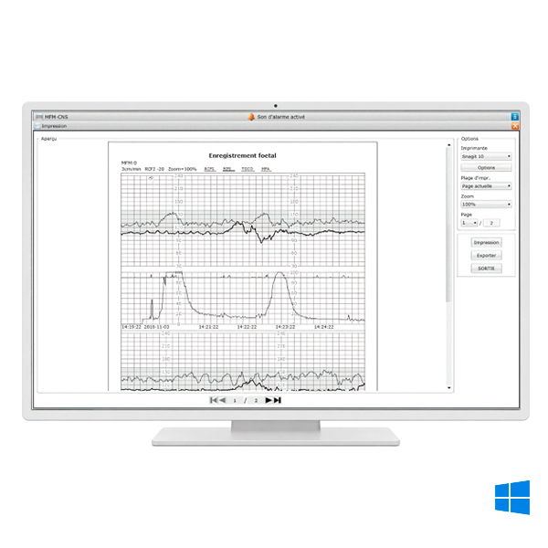 logiciel edan mfm-cns pour cardiotocographes edan