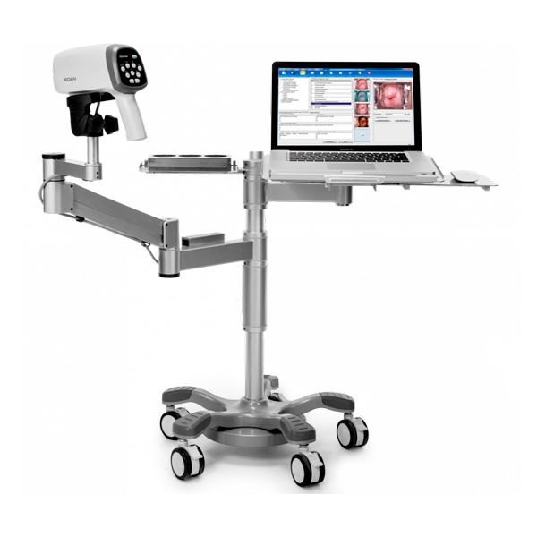 colposcope vidéo edan c6a