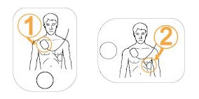 defibrillator installation scheme