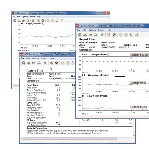 Oxymètre longue durée Contec CMS50F
