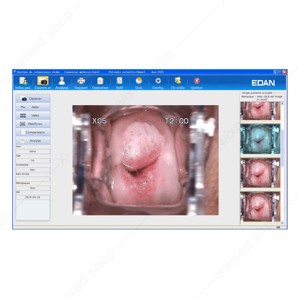 Logiciel d'évaluation R-WAY